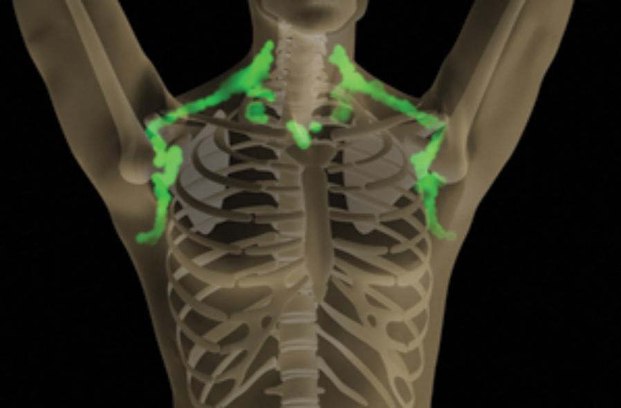 Artist rendition of a xray showing brown fat as glowing green