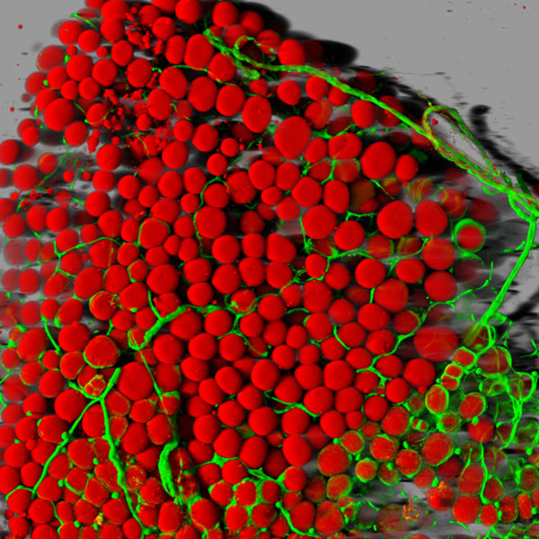 Fat cells in 3D