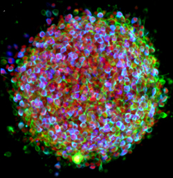 Photo of a brightly colored cluster of tiny cells.