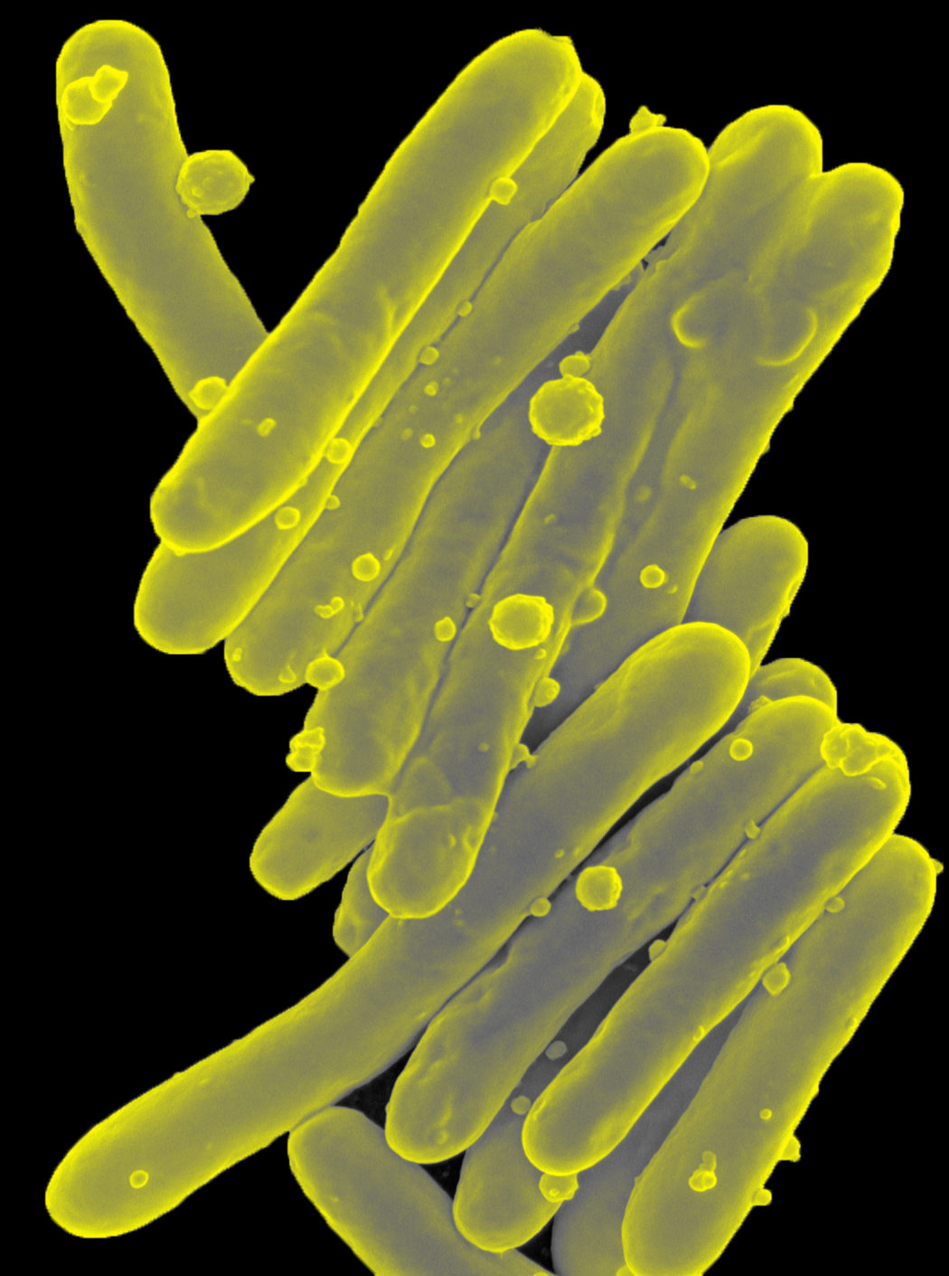 Microscopic image of a long, thin, rod-like bacteria