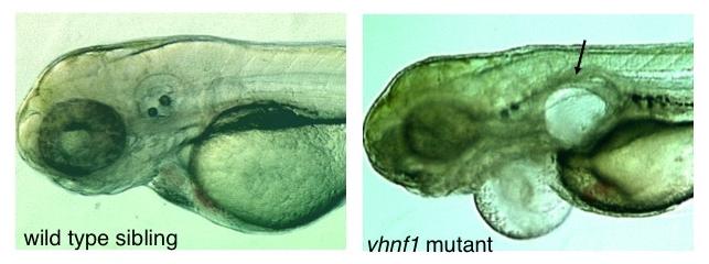 Images of both a wild type zebrafish and a vhnf1 mutant zebrafish. The mutant fish shows abnormal bulging in its upper body.