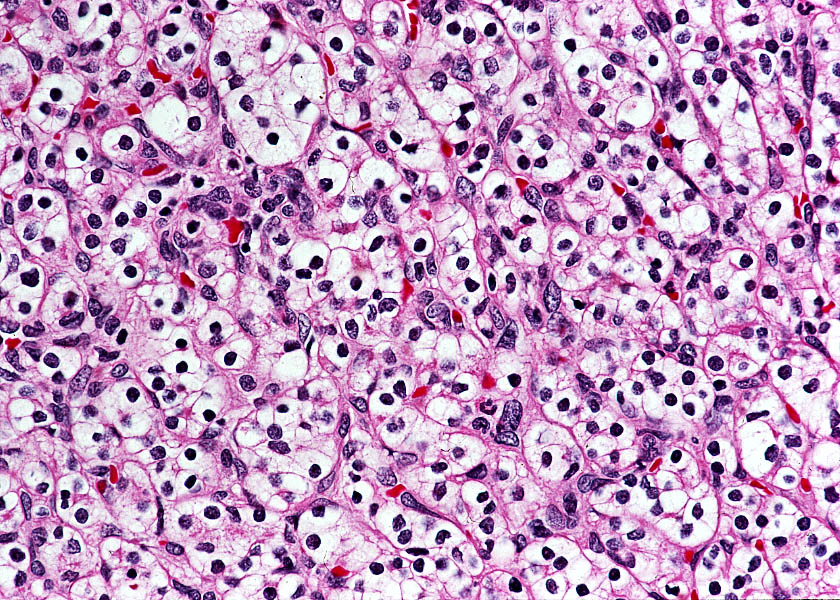Purple stained kidney tissue