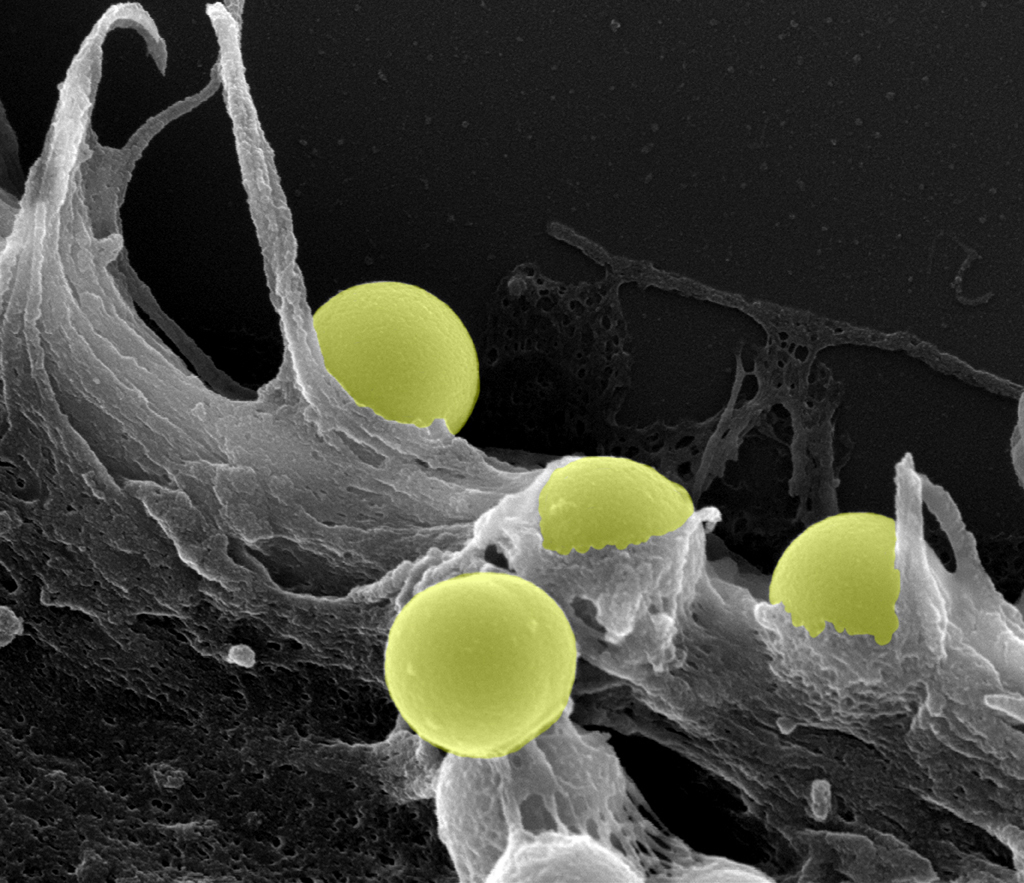 Photo of four bright yellow spheres on a textured gray surface