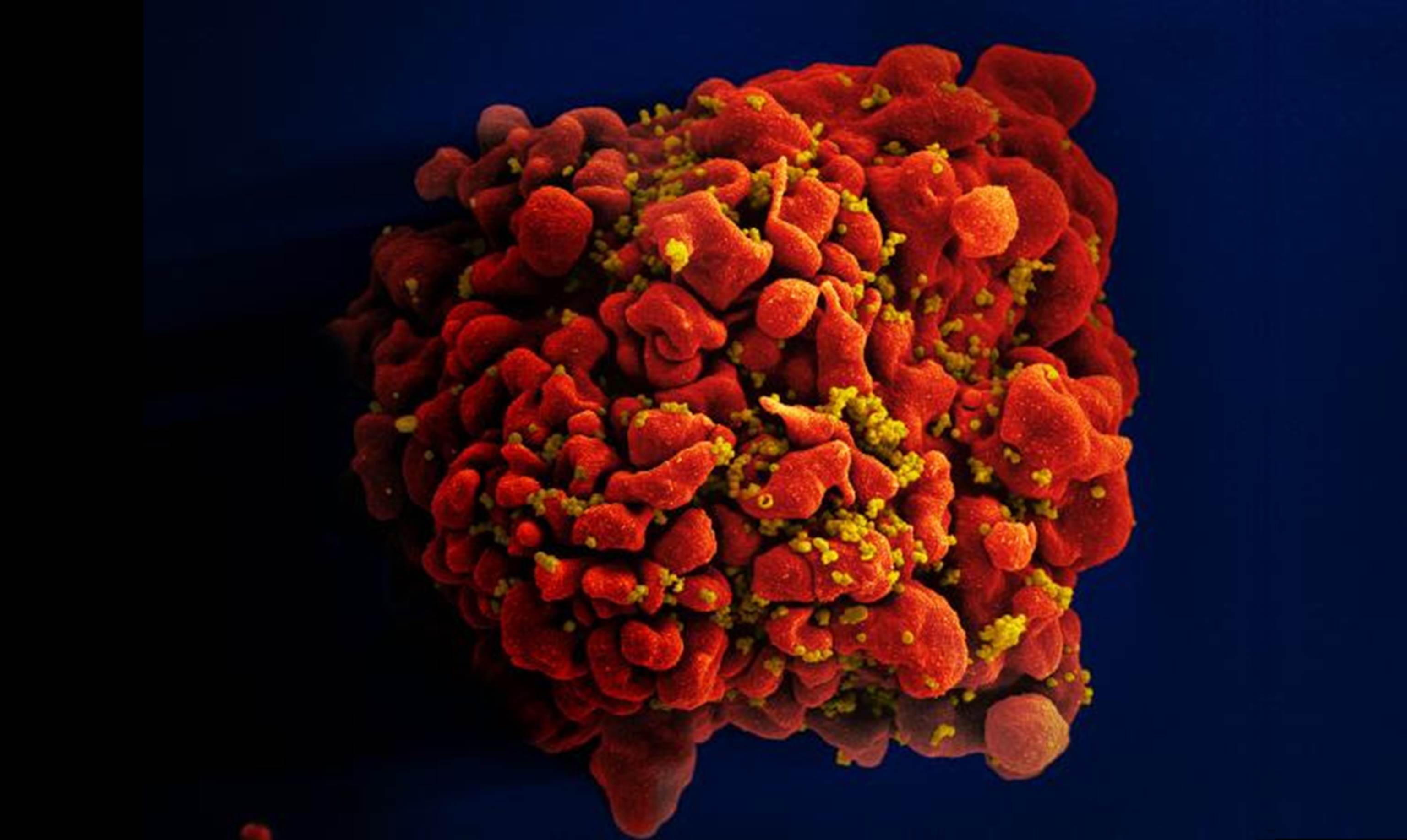 HIV-infected Immune Cell