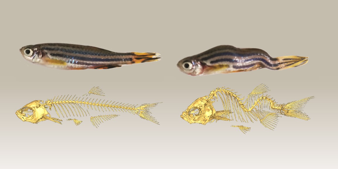 Zebra fish model for scoliosis study