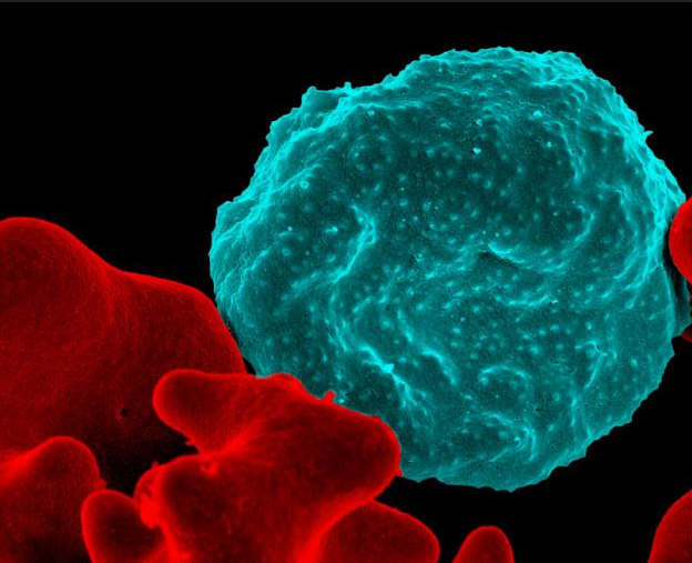 Red blood cell infected with malaria-causing parasites