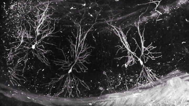 Pyramidal neurons in the cortex (layer 5) and hippocampus