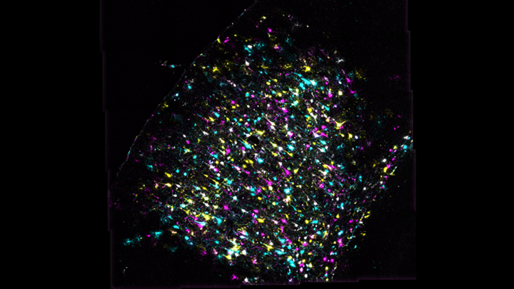 Thousands of neurons in the mouse brain