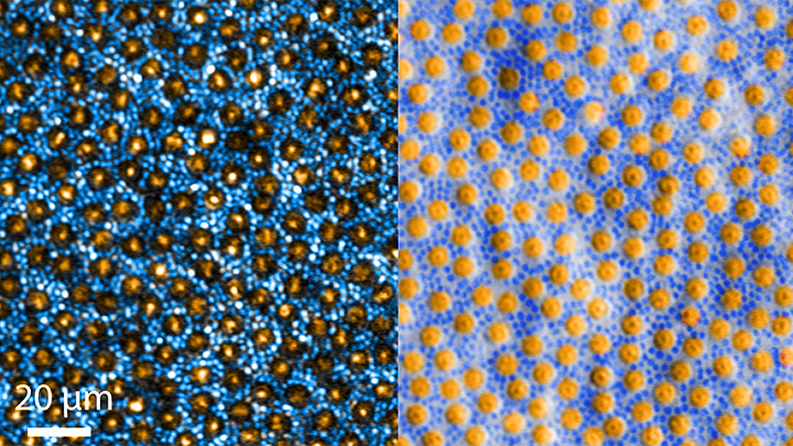 Two light microscopy fields of the retina showing small blue dots (rods) surrounding larger yellow dots (cones)