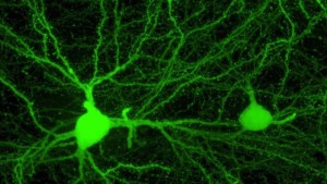 Light microscopy showing glowing green neurons and dendrites