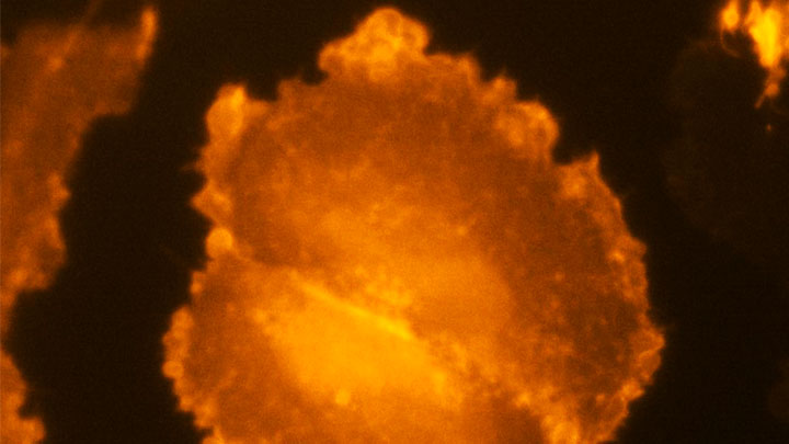 Light microscopy of an orange cell with ruffled border