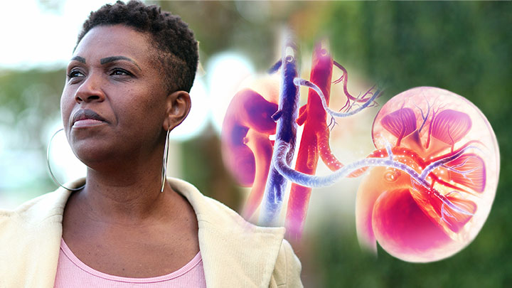 A black woman looking off-screen. Anatomical kidneys appear next to her