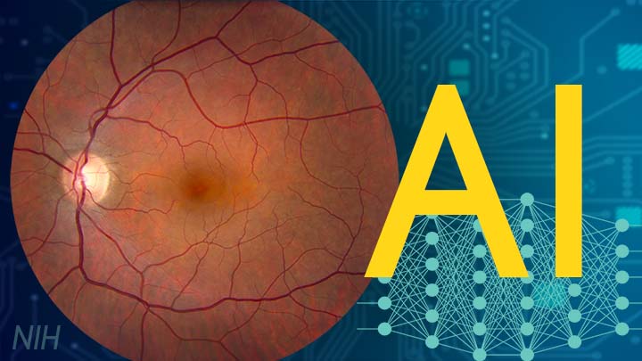 AI. Photograph of retina