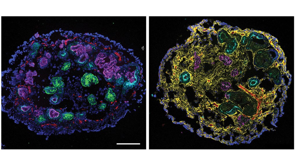 left: A ring of DAPI surrounds clusters of CDH1 and PODXL. right - a ring of DAPI surrounds a matrix of PDGFRβ