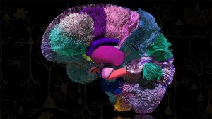 colored tracts create a model of the entire brain