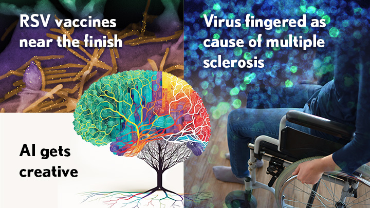 RSV vaccines near the finish. Virus fingered as cause of multiple sclerosis. AI gets creative.