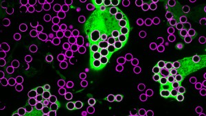 Dark light microscopy with man small circles. Green macrophages are nearly filled with some of the circles.