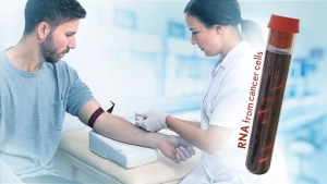 A nurse draws blood from the arm of a patient. To the side, RNA floats inside a vial of blood. The vial is labeled RNA from cancer cells.