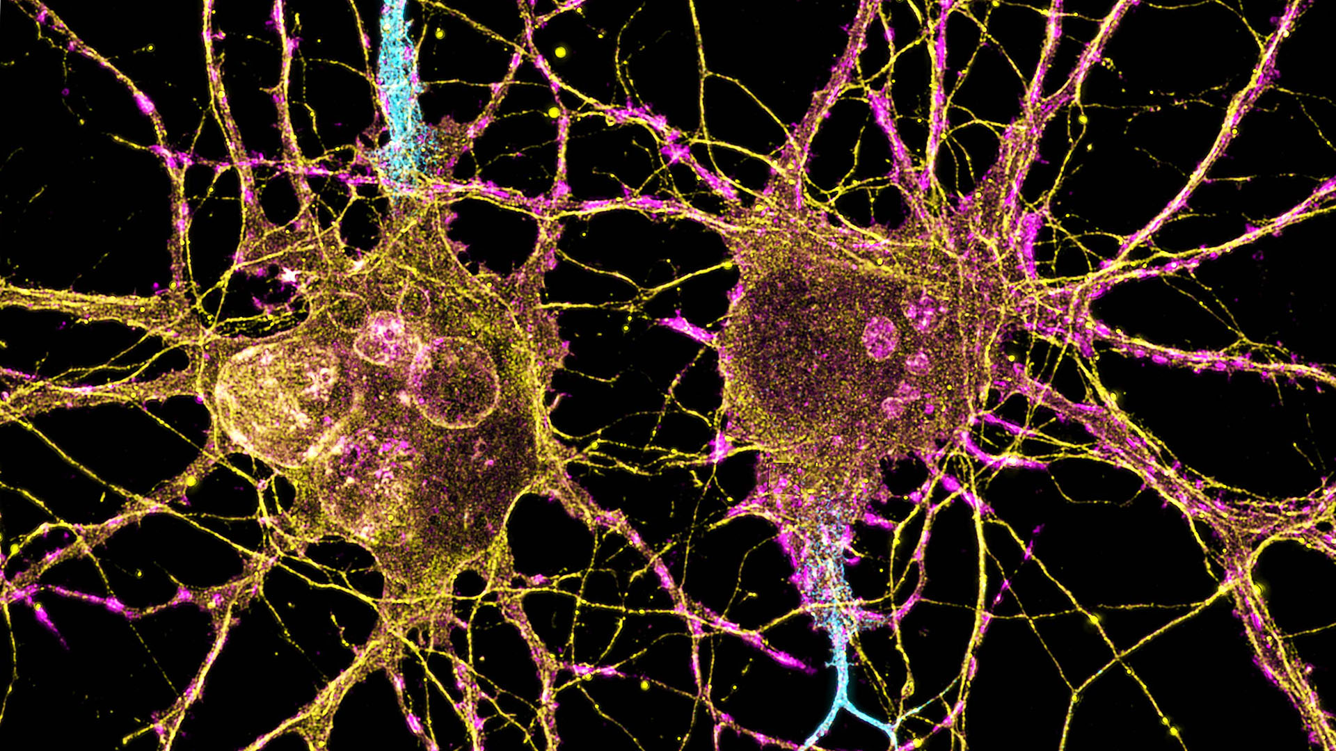 Human Brain Cell Atlas Offers Unprecedented Look at