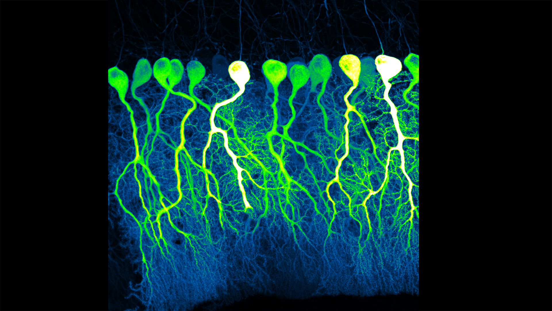 Photomicroscopy of neurons in a row