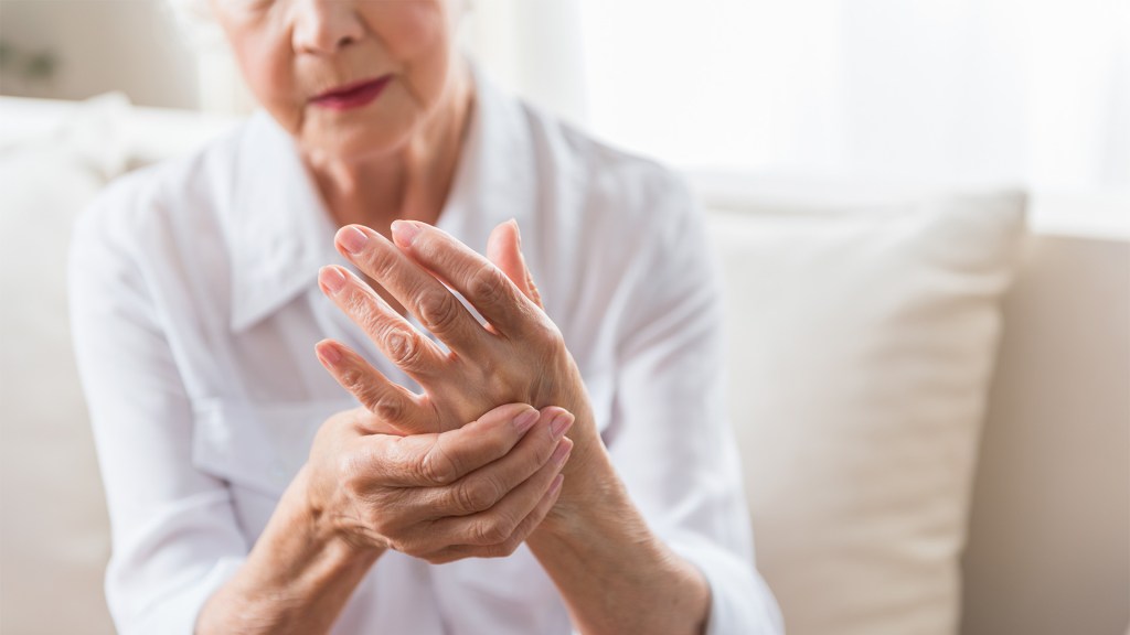 An older woman rubs her arthritic hands